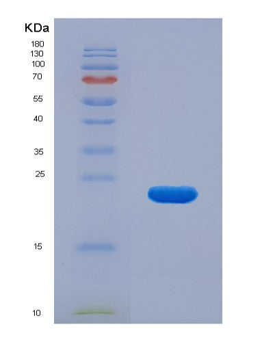 SDS-PAGE analysis of Human MANF (Mesencephalic Astrocyte-Derived Neurotrophic Factor) - Recombinant Protein, showing >85% purity under 15% SDS-PAGE (Reduced)