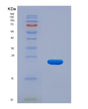 SDS-PAGE analysis of Human MANF (Mesencephalic Astrocyte-Derived Neurotrophic Factor) - Recombinant Protein, showing >85% purity under 15% SDS-PAGE (Reduced)