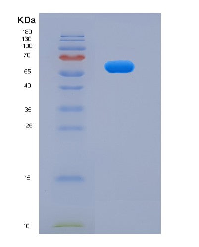 SDS-PAGE analysis of Mouse Pkm (Pyruvate Kinase Pkm) - Recombinant Protein, showing >90% purity under 15% SDS-PAGE (Reduced)