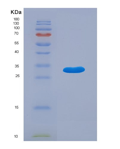 SDS-PAGE analysis of Human ADK (Adenosine Kinase) - Recombinant Protein, showing >95% purity under 15% SDS-PAGE (Reduced)