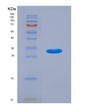 SDS-PAGE analysis of Human ADK (Adenosine Kinase) - Recombinant Protein, showing >95% purity under 15% SDS-PAGE (Reduced)