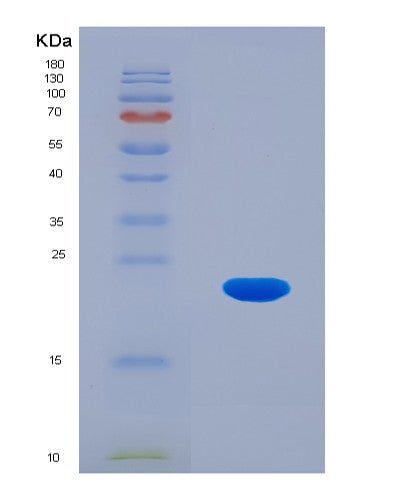 SDS-PAGE analysis of Human CDKN2D (Cyclin-Dependent Kinase 4 Inhibitor D) - Recombinant Protein, showing >95% purity under 15% SDS-PAGE (Reduced)