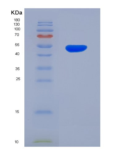 SDS-PAGE analysis of Human CDH11 (Cadherin-11) - Recombinant Protein, showing >95% purity under 15% SDS-PAGE (Reduced)