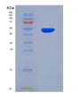 SDS-PAGE analysis of Human CDH11 (Cadherin-11) - Recombinant Protein, showing >95% purity under 15% SDS-PAGE (Reduced)