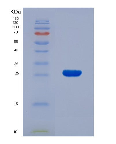 SDS-PAGE analysis of Human BID (Bh3-Interacting Domain Death Agonist) - Recombinant Protein, showing >95% purity under 15% SDS-PAGE (Reduced)