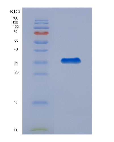SDS-PAGE analysis of Human LGALS4 (Galectin-4) - Recombinant Protein, showing >90% purity under 15% SDS-PAGE (Reduced)