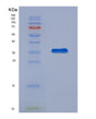 SDS-PAGE analysis of Human LGALS4 (Galectin-4) - Recombinant Protein, showing >90% purity under 15% SDS-PAGE (Reduced)