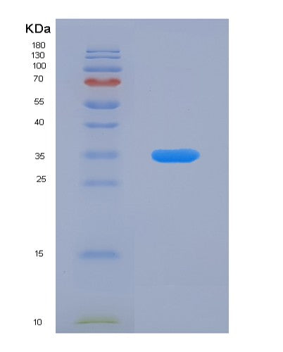 SDS-PAGE analysis of Human TPI1 (Triosephosphate Isomerase) - Recombinant Protein, showing >95% purity under 15% SDS-PAGE (Reduced)