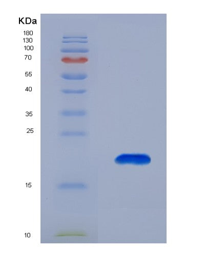 SDS-PAGE analysis of Human GMFB (Glia Maturation Factor Beta) - Recombinant Protein, showing >95% purity under 15% SDS-PAGE (Reduced)