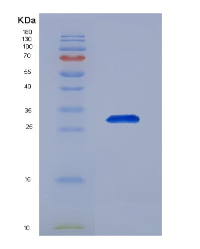 SDS-PAGE analysis of Human ACTR3 (Actin-Related Protein 3) - Recombinant Protein, showing >90% purity under 15% SDS-PAGE (Reduced)
