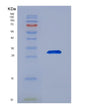 SDS-PAGE analysis of Human ACTR3 (Actin-Related Protein 3) - Recombinant Protein, showing >90% purity under 15% SDS-PAGE (Reduced)
