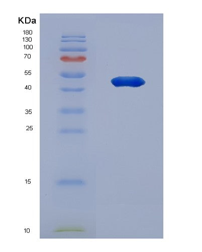 SDS-PAGE analysis of Human MAX (Protein Max) - Recombinant Protein, showing >95% purity under 15% SDS-PAGE (Reduced)