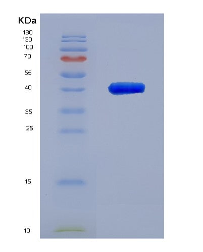 SDS-PAGE analysis of Human OSTN (Osteocrin) - Recombinant Protein, showing >85% purity under 15% SDS-PAGE (Reduced)