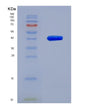 SDS-PAGE analysis of Human OSTN (Osteocrin) - Recombinant Protein, showing >85% purity under 15% SDS-PAGE (Reduced)