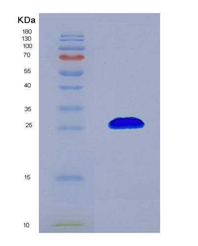 SDS-PAGE analysis of Human RHOA (Transforming Protein Rhoa) - Recombinant Protein, showing >90% purity under 15% SDS-PAGE (Reduced)