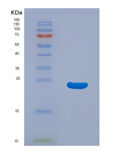 SDS-PAGE analysis of Human NCALD (Neurocalcin-Delta) - Recombinant Protein, showing >85% purity under 15% SDS-PAGE (Reduced)