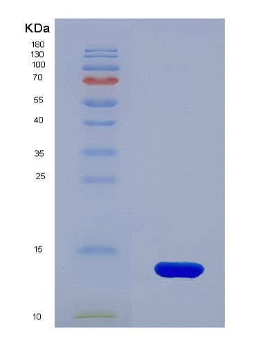 SDS-PAGE analysis of Human B2M (Beta-2-Microglobulin) - Recombinant Protein, showing >95% purity under 15% SDS-PAGE (Reduced)