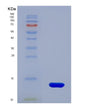 SDS-PAGE analysis of Human B2M (Beta-2-Microglobulin) - Recombinant Protein, showing >95% purity under 15% SDS-PAGE (Reduced)