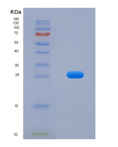 SDS-PAGE analysis of Human ACTA2 (Actin, Aortic Smooth Muscle) - Recombinant Protein, showing >90% purity under 15% SDS-PAGE (Reduced)