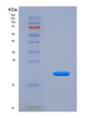 SDS-PAGE analysis of Human VSNL1 (Visinin-Like Protein 1) - Recombinant Protein, showing >85% purity under 15% SDS-PAGE (Reduced)