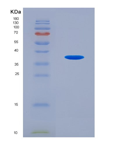 SDS-PAGE analysis of Human CDK13 (Cyclin-Dependent Kinase 13) - Recombinant Protein, showing >90% purity under 15% SDS-PAGE (Reduced)