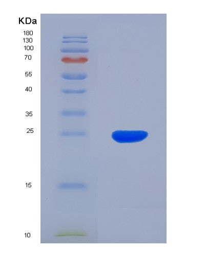 SDS-PAGE analysis of Human RAC1 (Ras-Related C3 Botulinum Toxin Substrate 1) - Recombinant Protein, showing >85% purity under 15% SDS-PAGE (Reduced)