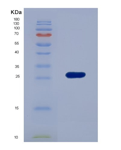 SDS-PAGE analysis of Mouse Tpt1 (Translationally-Controlled Tumor Protein) - Recombinant Protein, showing >95% purity under 15% SDS-PAGE (Reduced)