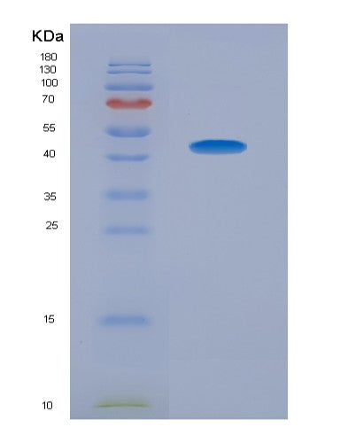 SDS-PAGE analysis of Mouse Vamp2 (Vesicle-Associated Membrane Protein 2) - Recombinant Protein, showing >95% purity under 15% SDS-PAGE (Reduced)