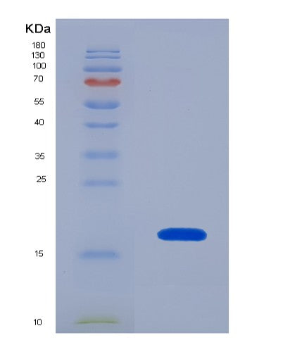SDS-PAGE analysis of Human YWHAZ (14-3-3 Protein Zeta/Delta) - Recombinant Protein, showing >90% purity under 15% SDS-PAGE (Reduced)