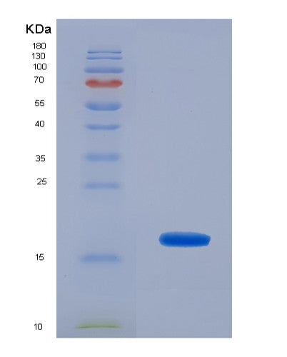 SDS-PAGE analysis of Human UBE2I (Sumo-Conjugating Enzyme Ubc9) - Recombinant Protein, showing >85% purity under 15% SDS-PAGE (Reduced)