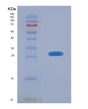 SDS-PAGE analysis of Mouse Lxn (Latexin) - Recombinant Protein, showing >95% purity under 15% SDS-PAGE (Reduced)