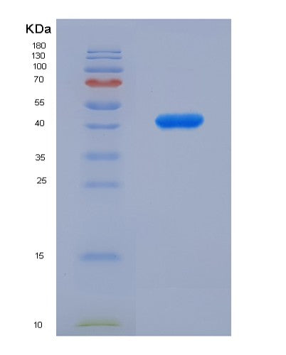 SDS-PAGE analysis of Human ARG2 (Arginase-2, Mitochondrial) - Recombinant Protein, showing >95% purity under 15% SDS-PAGE (Reduced)