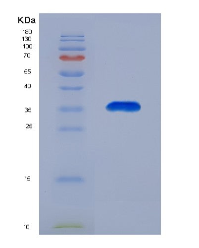 SDS-PAGE analysis of Mouse Gnrhr (Gonadotropin-Releasing Hormone Receptor) - Recombinant Protein, showing >90% purity under 15% SDS-PAGE (Reduced)
