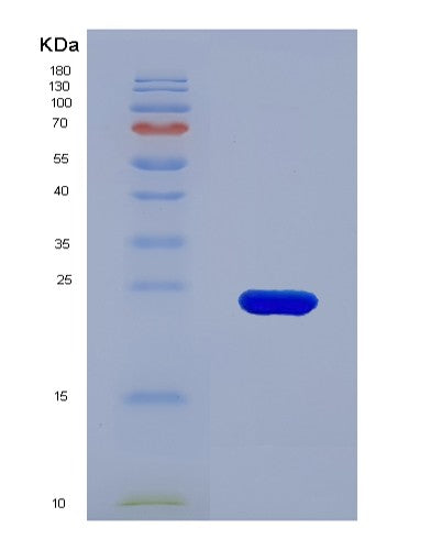 SDS-PAGE analysis of Human LCN2 (Neutrophil Gelatinase-Associated Lipocalin) - Recombinant Protein, showing >85% purity under 15% SDS-PAGE (Reduced)