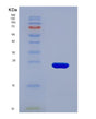 SDS-PAGE analysis of Human LCN2 (Neutrophil Gelatinase-Associated Lipocalin) - Recombinant Protein, showing >85% purity under 15% SDS-PAGE (Reduced)