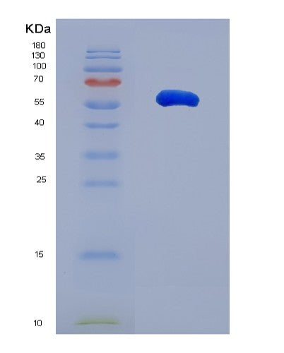 SDS-PAGE analysis of Human BASP1 (Brain Acid Soluble Protein 1) - Recombinant Protein, showing >95% purity under 15% SDS-PAGE (Reduced)