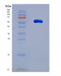 SDS-PAGE analysis of Human BASP1 (Brain Acid Soluble Protein 1) - Recombinant Protein, showing >95% purity under 15% SDS-PAGE (Reduced)