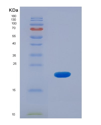 SDS-PAGE analysis of Human DDX39B (Spliceosome Rna Helicase Ddx39B) - Recombinant Protein, showing >90% purity under 15% SDS-PAGE (Reduced)