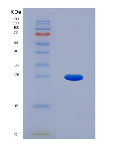 SDS-PAGE analysis of Mouse Ctsb (Cathepsin B) - Recombinant Protein, showing >90% purity under 15% SDS-PAGE (Reduced)