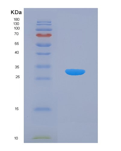 SDS-PAGE analysis of Human LEPR (Leptin Receptor) - Recombinant Protein, showing >90% purity under 15% SDS-PAGE (Reduced)