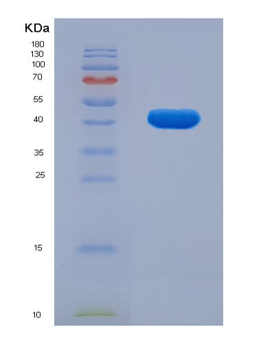 SDS-PAGE analysis of Mouse Drd1 (D(1A) Dopamine Receptor) - Recombinant Protein, showing >90% purity under 15% SDS-PAGE (Reduced)