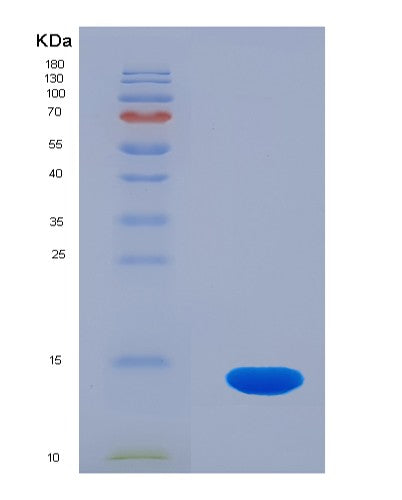SDS-PAGE analysis of Human PLOD3 (Multifunctional Procollagen Lysine Hydroxylase And Glycosyltransferase Lh3) - Recombinant Protein, showing >90% purity under 15% SDS-PAGE (Reduced)