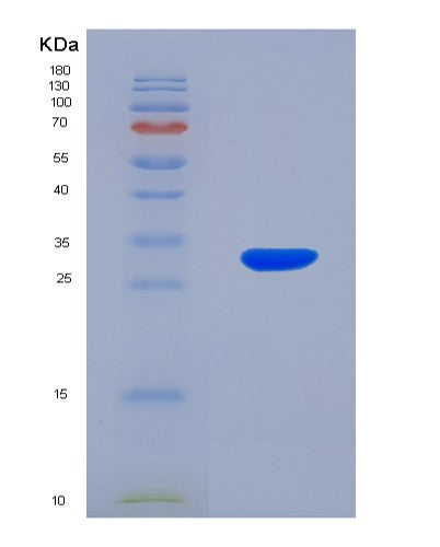 SDS-PAGE analysis of Human PLA2R1 (Secretory Phospholipase A2 Receptor) - Recombinant Protein, showing >90% purity under 15% SDS-PAGE (Reduced)