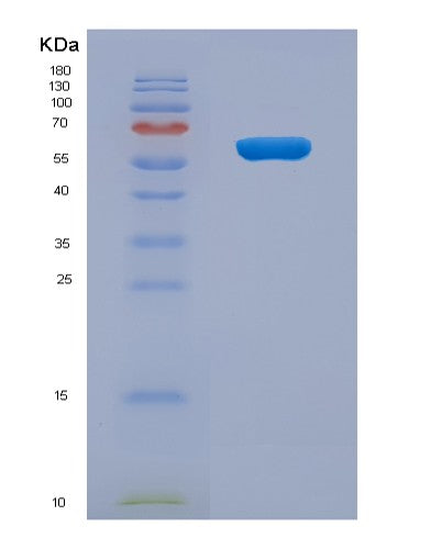 SDS-PAGE analysis of Human XIAP (E3 Ubiquitin-Protein Ligase Xiap) - Recombinant Protein, showing >90% purity under 15% SDS-PAGE (Reduced)