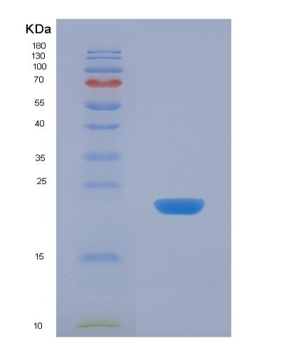 SDS-PAGE analysis of Human APOD (Apolipoprotein D) - Recombinant Protein, showing >90% purity under 15% SDS-PAGE (Reduced)