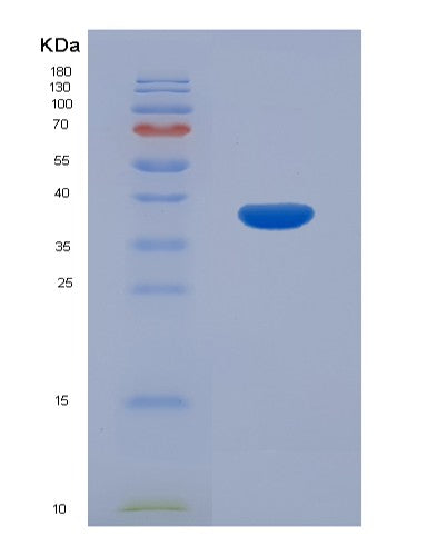 SDS-PAGE analysis of Mouse Mt1 (Metallothionein-1) - Recombinant Protein, showing >90% purity under 15% SDS-PAGE (Reduced)