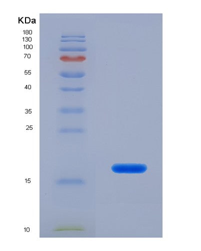 SDS-PAGE analysis of Human MYL7 (Myosin Regulatory Light Chain 2, Atrial Isoform) - Recombinant Protein, showing >85% purity under 15% SDS-PAGE (Reduced)