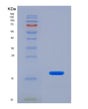 SDS-PAGE analysis of Human MYL7 (Myosin Regulatory Light Chain 2, Atrial Isoform) - Recombinant Protein, showing >85% purity under 15% SDS-PAGE (Reduced)