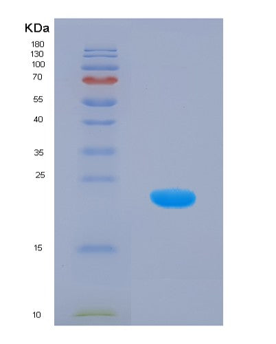 SDS-PAGE analysis of Human HMGCS1 (Hydroxymethylglutaryl-Coa Synthase, Cytoplasmic) - Recombinant Protein, showing >85% purity under 15% SDS-PAGE (Reduced)