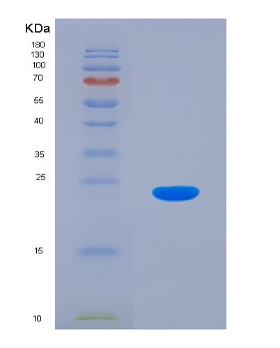 SDS-PAGE analysis of Human DR1 (Protein Dr1) - Recombinant Protein, showing >90% purity under 15% SDS-PAGE (Reduced)